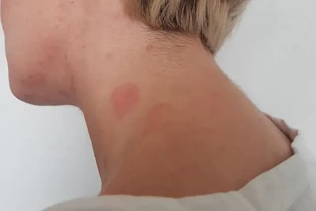 Czy Shellac uczula? Sprawdź ryzyko alergii i porównanie z Semilac Czy Shellac uczula? Sprawdź ryzyko alergii i porównanie z Semilac