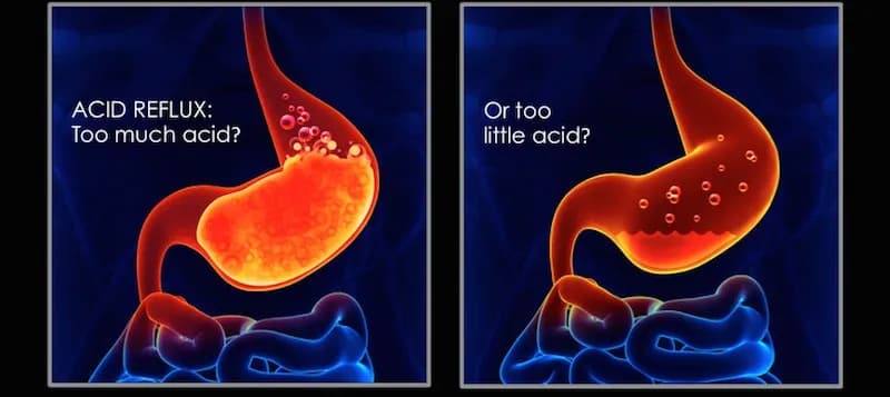 Niedokwaśność żołądka objawy – poznaj, co może ci dolegać Niedokwaśność żołądka objawy – poznaj, co może ci dolegać