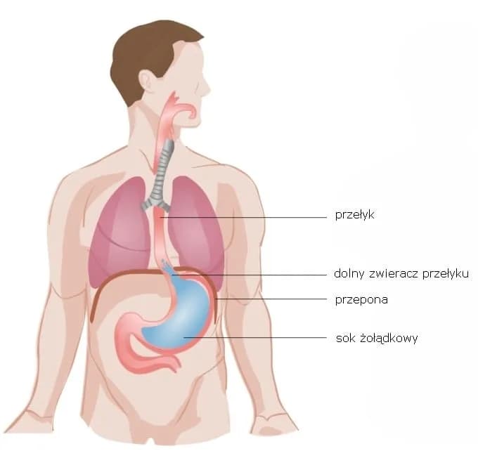 Kaszel refluksowy objawy – jak rozpoznać i uniknąć bólu gardła Kaszel refluksowy objawy – jak rozpoznać i uniknąć bólu gardła