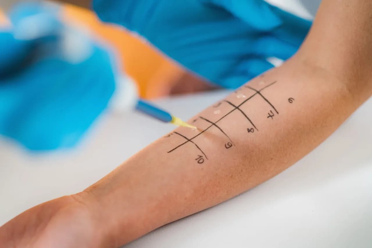 Czy jagua uczula? Dowiedz się, jak unikać alergicznych reakcji Czy jagua uczula? Dowiedz się, jak unikać alergicznych reakcji