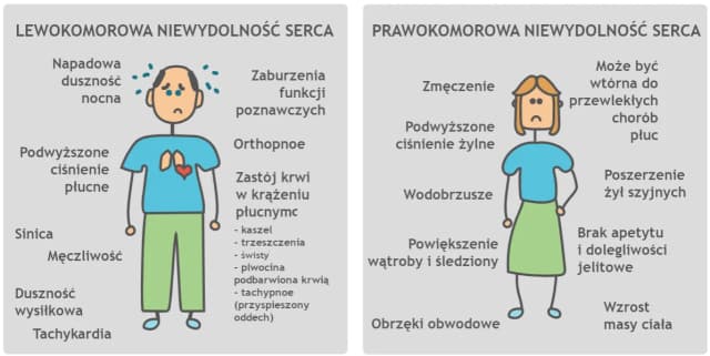 Niewydolność serca objawy – jak je rozpoznać i kiedy szukać pomocy Niewydolność serca objawy – jak je rozpoznać i kiedy szukać pomocy