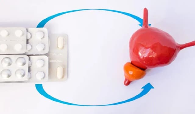 Skuteczne leki na częste oddawanie moczu – ulga w dolegliwościach Skuteczne leki na częste oddawanie moczu – ulga w dolegliwościach