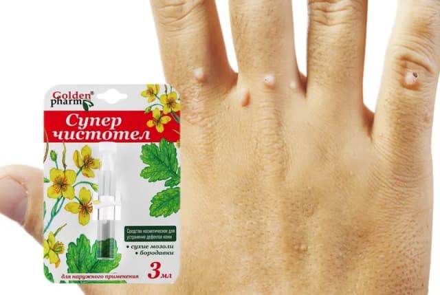 Skuteczne leki na włókniaki: uniknij bólu i podrażnień Skuteczne leki na włókniaki: uniknij bólu i podrażnień