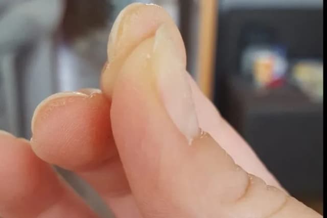 Czy akryl żel uczula? Objawy alergii i bezpieczne alternatywy Czy akryl żel uczula? Objawy alergii i bezpieczne alternatywy