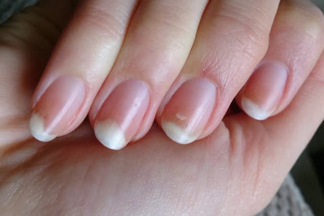 Czy żel uczula jak hybryda? Sprawdź, zanim użyjesz! Czy żel uczula jak hybryda? Sprawdź, zanim użyjesz!