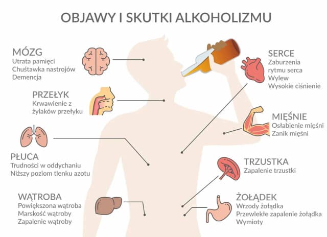 Czy codzienne picie alkoholu to alkoholizm? Zrozum skutki i objawy Czy codzienne picie alkoholu to alkoholizm? Zrozum skutki i objawy